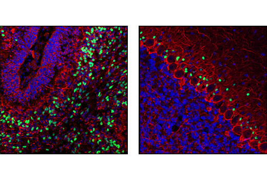 Confocal immunofluorescent analysis of postnatal day 1 (left) and adult (right) rat brain using SOX1 Antibody (green) and Neurofilament-L (DA2) Mouse mAb #2835 (red). Blue pseudocolor = DRAQ5 ® #4084 (fluorescent DNA dye).