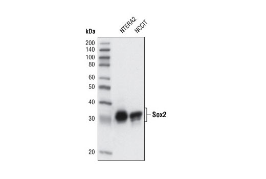 Western blot analysis of extracts of NTERA2 and NCCIT cells using Sox2 (L73B4) Mouse mAb.