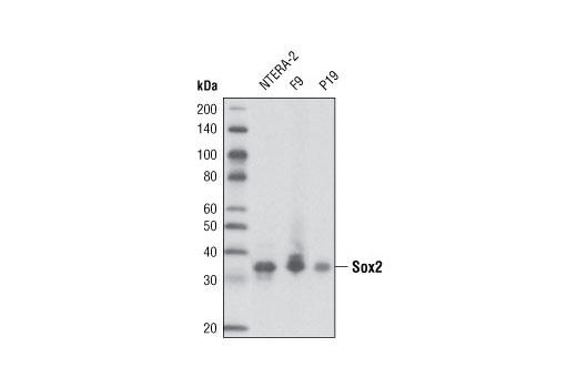 Western blot analysis of extracts from NTERA-2, F9 and P16 cells using Sox2 (L1D6A2) Mouse mAb.