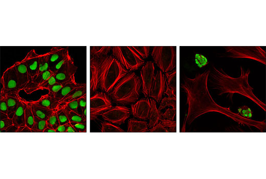 Confocal immunofluorescent analysis of NTERA-2 (left), HeLa (center) and mouse ES cells growing on MEF feeder cells (right) using Sox2 (L1D6A2) Mouse mAb (green). Actin filaments were labeled with DY-554 phalloidin (red).
