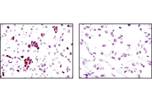 Immunohistochemical analysis of paraffin-embedded F9 cells (positive, left) and C2C12 cells (negative, right) using Sox2 (C70B1) Rabbit mAb (IHC Preferred).