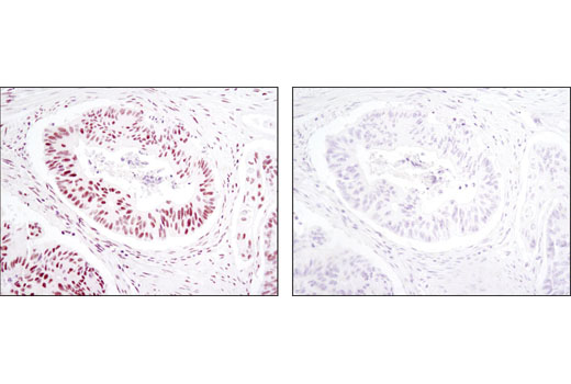 Immunohistochemical analysis of paraffin-embedded human colon carcinoma using SP1 (D4C3) Rabbit mAb in the presence of control peptide (left) or antigen-specific peptide (right).