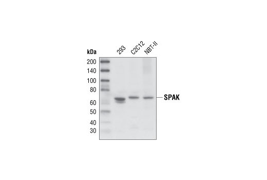 Western blot analysis of extracts from 293, C2C12 and NBT-II cells, using SPAK Antibody.