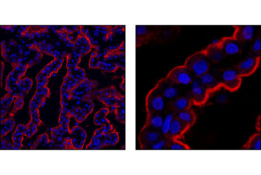 Confocal immunofluorescent analysis of choroid plexus epithelial cells showing apical membrane localization, using SPAK Antibody (red). Blue pseudocolor = DRAQ5 ® #4084 (fluorescent DNA dye).
