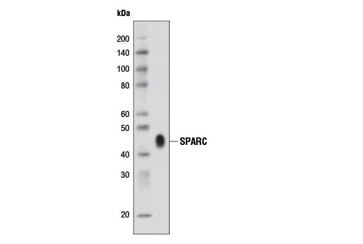 Western blot analysis of culture medium, from SPARC-secreting PYS-2 cells, using SPARC (D10F10) Rabbit mAb.