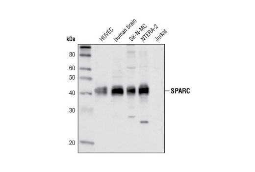 Western blot analysis of various cell extracts using SPARC Antibody. Jurkat are negative, as expected.