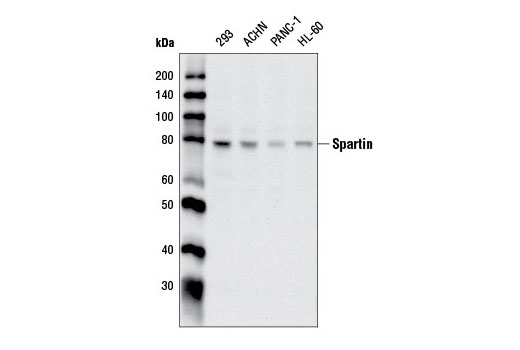 Western blot analysis of extracts from various cell lines using Spartin Antibody.