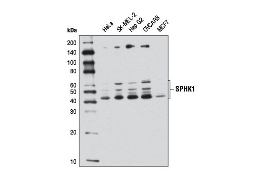 Western blot analysis of extracts from various cell lines using SPHK1 (D1H1L) Rabbit mAb.