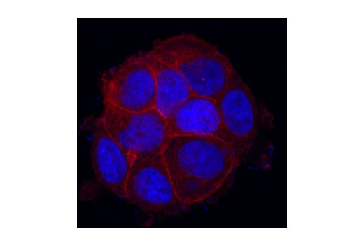 Confocal immunofluorescent analysis of MCF7 cells labeled with Src Antibody (red). Blue=DRAQ5 ® #4084 fluorescent DNA dye.