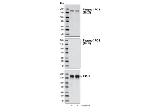 Western blot analysis of cell extracts from MCF-7 cells, untreated or stimulated with heregulin, using Phospho-SRC-3 (Thr24) Antibody (upper and middle) or SRC-3 (5E11) Rabbit mAb #2126 (lower). The middle blot was treated with calf intestinal phosphatase (CIP) before antibody probing.