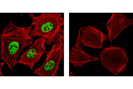 Confocal immunofluorescent analysis of HeLa cells, either untreated (left) or λ-phosphatase treated (right), using Phospho-SRC-3 (Thr24) Antibody (green). Actin filaments have been labeled with DY-554 phalloidin (red).