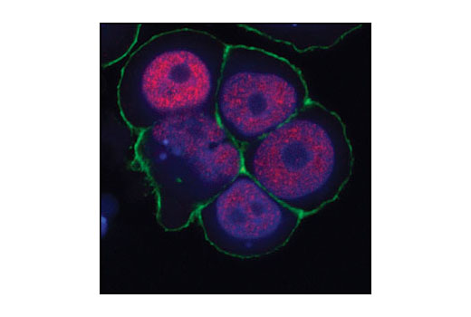Confocal immunofluorescence images of MCF-7 cells labeled with SRC-3 (11B1) Mouse mAb (red). Actin filaments have been labeled with fluorescein phalloidin. Blue pseudocolor = DRAQ5 ® #4084 (fluorescent DNA dye).