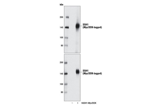 Western blot analysis of extracts from 293T cells, mock transfected (-) or transfected with a construct expressing Myc/DDK-tagged full-length human SSH1 protein (hSSH1-Myc/DDK; +), using SSH1 (E1K3W) Rabbit mAb (upper) or Myc-Tag (71D10) Rabbit mAb #2278 (lower).