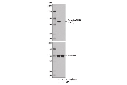 Western blot analysis of extracts from ZR-75-1 cells, untreated or λ phosphatase and CIP-treated, using Phospho-SSH3 (Ser37) Antibody (upper) or α-Actinin (D6F6) XP ® Rabbit mAb #6487 (lower).