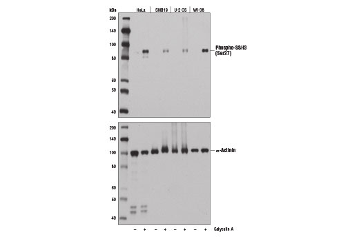 Western blot analysis of extracts from various cell lines, untreated or Calyculin A #9902-treated, using Phospho-SSH3 (Ser37) Antibody (upper) or α-Actinin (D6F6) XP ® Rabbit mAb #6487 (lower).