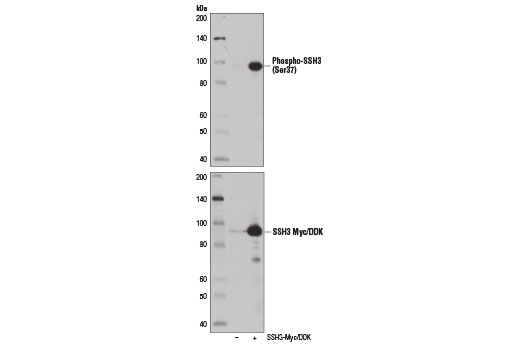 Western blot analysis of extracts from 293T cells, untransfected or transfected with a construct expressing Myc/DDK-tagged full-length human SSH3 protein, using Phospho-SSH3 (Ser37) Antibody (upper) and Myc-Tag (71D10) Rabbit mAb #2278 (lower).