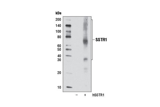 Western blot analysis of extracts from COS-7 cells, mock transfected (-) or transfected with a construct expressing human SSTR1 (hSSTR1; +), using SSTR1 Antibody. Multiple bands are thought to be GPCR dimers and/or oligomers (Rozenfeld, R. and Devi, L.A. (2010) Handbook of Cell Signaling, 2nd edition, 185-94). Smearing is thought to be due to the addition of N-linked glycosylations at specific NXS/T motifs (Dong, C. et al. (2007) Biochem Biophys Acta 1768, 853-70).