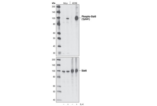 Western blot analysis of extracts from HeLa and ACHN cells, untreated or treated with IL-4 (15 min), using Phospho-Stat6 (Tyr641) (C11A12) Rabbit mAb (upper) or Stat6 Antibody #9362 (lower).