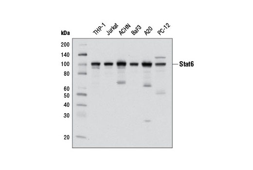 Western blot analysis of extracts from various cell lines using Stat6 (D3H4) Rabbit mAb.