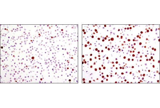 Immunohistochemical analysis of paraffin-embedded HT-29 cell pellets, untreated (left) or nocodazole-treated (right), using Phospho-Stathmin (Ser38) (D19H10) Rabbit mAb.