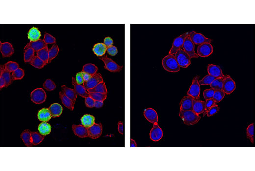 Confocal immunofluorescent analysis of HT-29 cells, untreated (left) or λ phosphatase-treated (right), using Phospho-Stathmin (Ser38) (D19H10) Rabbit mAb (green). Actin filaments were labeled with DY-554 phalloidin (red). Blue pseudocolor = DRAQ5 ® #4084 (fluorescent DNA dye).