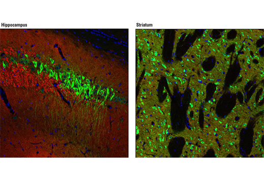 Confocal immunofluorescent analysis of rat hippocampus (left) and striatum (right) using Non-phospho-STEP (Ser221) (D74H3) XP ® Rabbit mAb (green) and α/β-Synuclein (Syn205) Mouse mAb #2644 (red). Blue pseudocolor = DRAQ5 ® #4084 (fluorescent DNA dye).