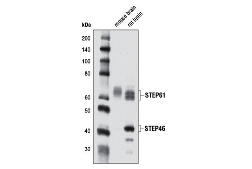 Western blot analysis of extracts from mouse and rat brain using STEP (D9H3) Rabbit mAb.