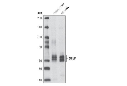 Western blot analysis of extracts from mouse and rat brain using STEP Antibody.