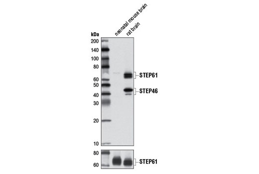 Western blot analysis of extracts from neonatal mouse brain and rat brain using STEP (D7E2) Rabbit mAb (upper) and STEP (D9H3) Rabbit mAb #9069 (lower).