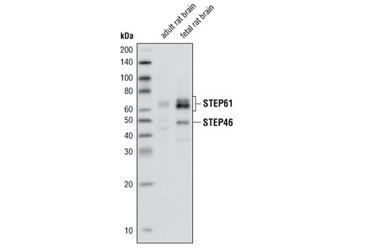 Western blot analysis of extracts from adult rat and fetal rat brain using STEP (23E5) Mouse mAb.