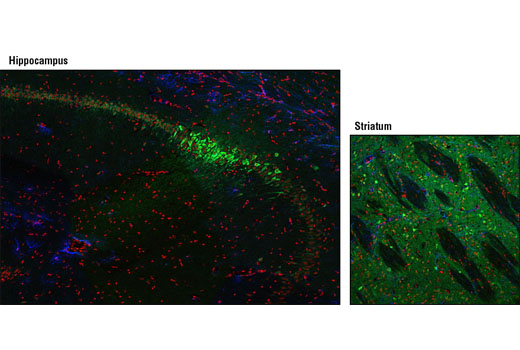 Confocal immunofluorescent analysis of rat hippocampus (left) and striatum (right) using STEP (23E5) Mouse mAb (green) and GFAP (GA5) Mouse mAb (Alexa Fluor ® 647 Conjugate) #3657 (blue). Red = propidium iodide (fluorescent DNA dye).