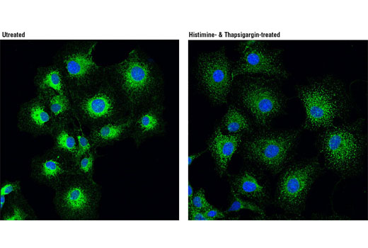 Confocal immunofluorescent analysis of COS-7 cells, untreated (left) or treated with histamine and thapsigargin (right) using STIM1 (D88E10) Rabbit mAb (green). Blue pseudocolor = DRAQ5 ® #4084 (fluorescent DNA dye).