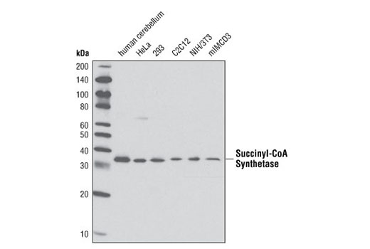 Western blot analysis of extracts from various cell lines and tissue using Succinyl-CoA Synthetase Antibody.