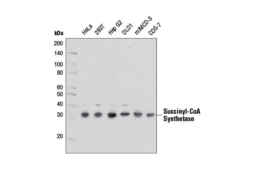 Western blot analysis of extracts from various cell lines using Succinyl-CoA Synthetase (D8A11) Rabbit mAb.