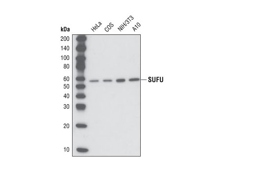 Western blot analysis of total cell lysates from various cell types using SUFU (C54G2) Rabbit mAb.