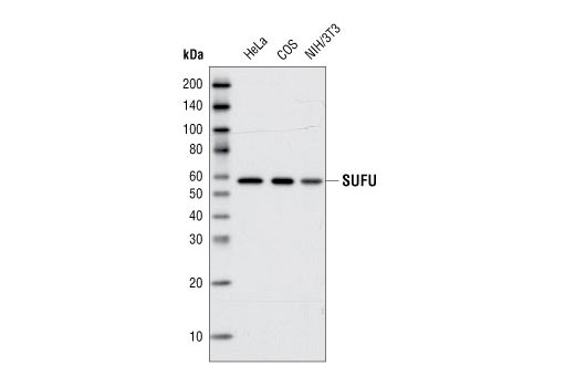Western blot analysis of total cell lysates from HeLa, COS and NIH/3T3 cells using SUFU (C81H7) Rabbit mAb.