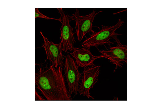 Confocal immunofluorescent analysis of HeLa cells using SUMO-2/3 (18H8) Rabbit mAb (green). Actin filaments were labeled with DyLight® 554 Phalloidin #13054 (red).