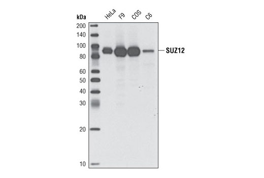 Western blot analysis of extracts from various cell lines using SUZ12 (D39F6) XP ® Rabbit mAb.