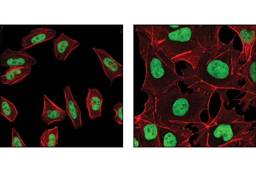 Confocal immunofluorescent analysis of HeLa cells (left) and NTERA2 cells (right) using SUZ12 (D39F6) XP ® Rabbit mAb (green). Actin filaments have been labeled with DY-554 phalloidin (red).