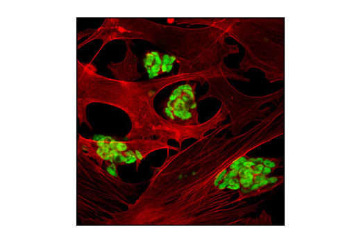 Confocal immunofluorescent analysis of mouse embryonic stem cells growing on mouse embryonic fibroblast (MEF) feeder cells using SUZ12 (D39F6) XP ® Rabbit mAb (green). Actin filaments have been labeled with DY-554 phalloidin (red).