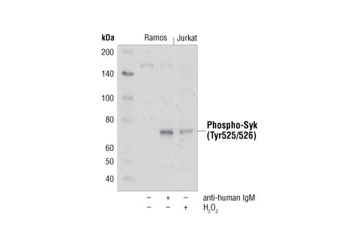 Western blot analysis of extracts from Ramos cells, untreated or treated with anti-human IgM (12ug/ml, 2 minutes) and Jurkat cells treated with hydrogen peroxide (2mM, 2 minutes) using Phospho-Syk (Tyr525/526) Antibody.