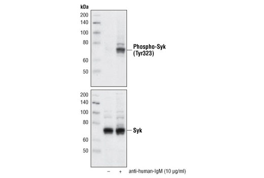 Western blot analysis of extracts from Ramos cells, untreated or treated with anti-human-IgM (10 µg/ml), using Phospho-Syk (Tyr323) Antibody #2715 (upper) or Syk Antibody #2712 (lower).
