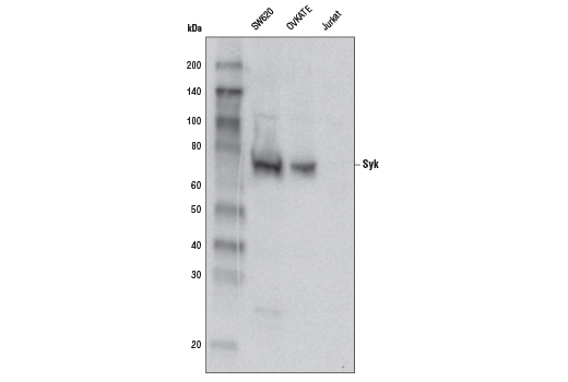 Western blot analysis of extracts from Jurkat (lane 1) and THP1 (lane 2) cells, and untransfected or Syk cDNA-transfected DT40 cells, treated as indicated (lanes 3-5), using Syk Antibody.