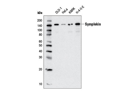 Western blot analysis of extracts from various cell lines using Symplekin (D5Y3T) Rabbit mAb.