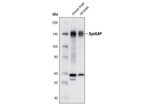 Western blot analysis of extracts from mouse and rat brain using SynGAP (D78B11) Rabbit mAb.