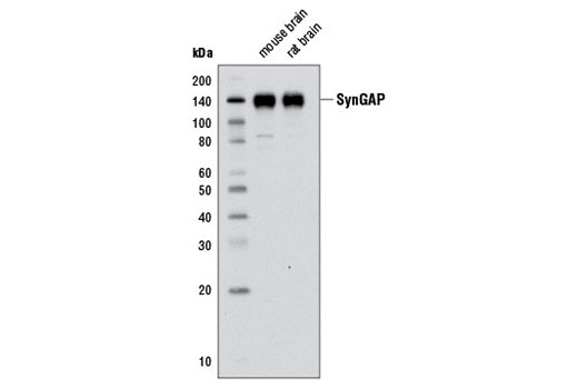Western blot analysis of extracts from mouse and rat brain tissue using SynGAP (D88G1) Rabbit mAb.