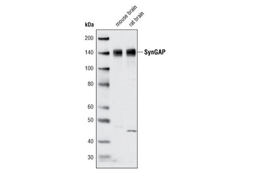 Western blot analysis of extracts from mouse and rat brain tissue using SynGAP Antibody.