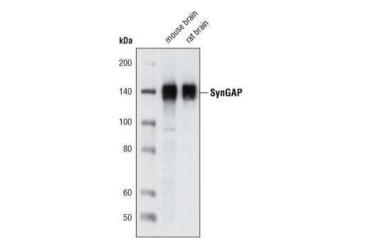 Western blot analysis of extracts from mouse and rat brain tissue using SynGAP (D20C7) Rabbit mAb.