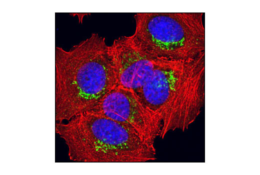 Confocal immunofluorescent analysis of MCF7 cells using Syntaxin 6 (C34B2) Rabbit mAb (green). Actin filaments have been labeled with DY-554 phalloidin (red). Blue pseudocolor = DRAQ5™ (fluorescent DNA dye).