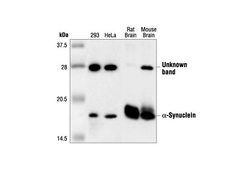 Western blot analysis of extracts from 293, HeLa, rat brain and mouse brain cell extracts, using α-Synuclein Antibody.